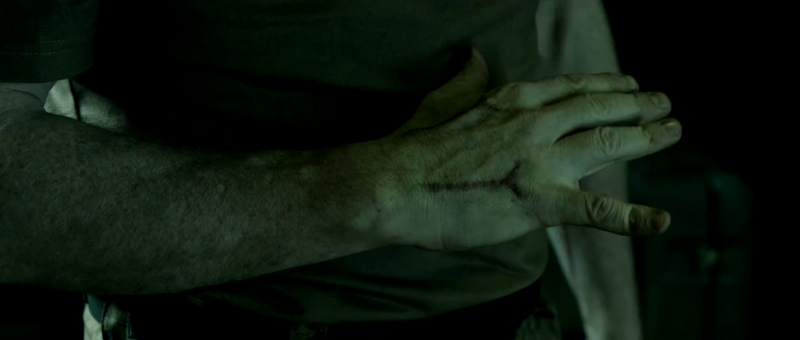 Fichier:HNF-Randall cicatrices Spartan.png